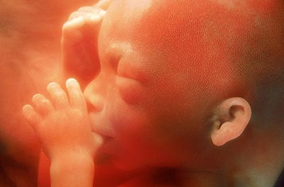 胎儿发育异常的表现