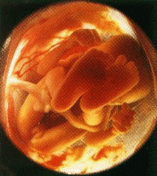 孕期羊水过多常见的原因有