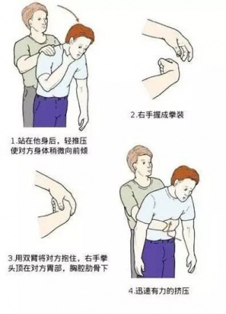 这九个日常急救常识竟然都是错的！家长教过，影视剧里也常见