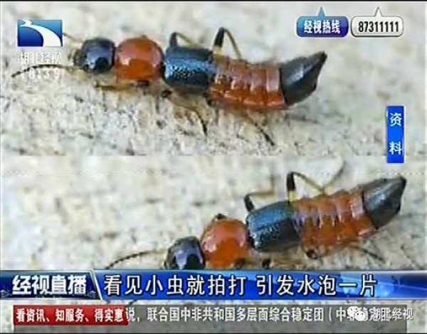 警报！厦门女大学生睡梦中脸痒挠了下，醒来进医院！这危险高发，已有人毁容