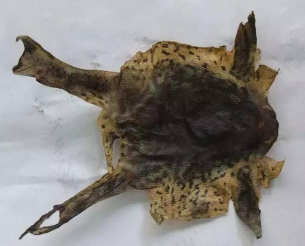 小儿湿疹，药一停就复发？中医博士送您几个方子，内服外用除病根